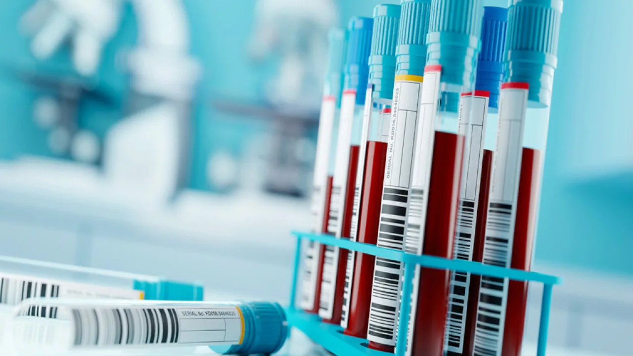 Hallan algo extraño en la sangre de pacientes con covid-19 persistente